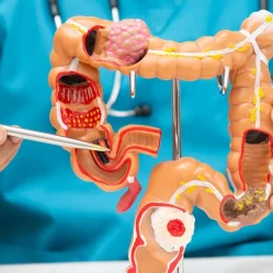Cáncer colorrectal