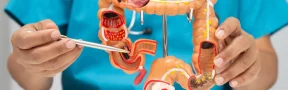 Cáncer colorrectal