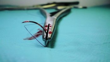 Donación de Órganos